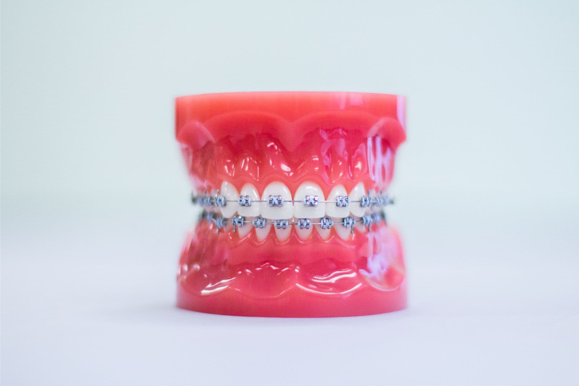 braces somerville