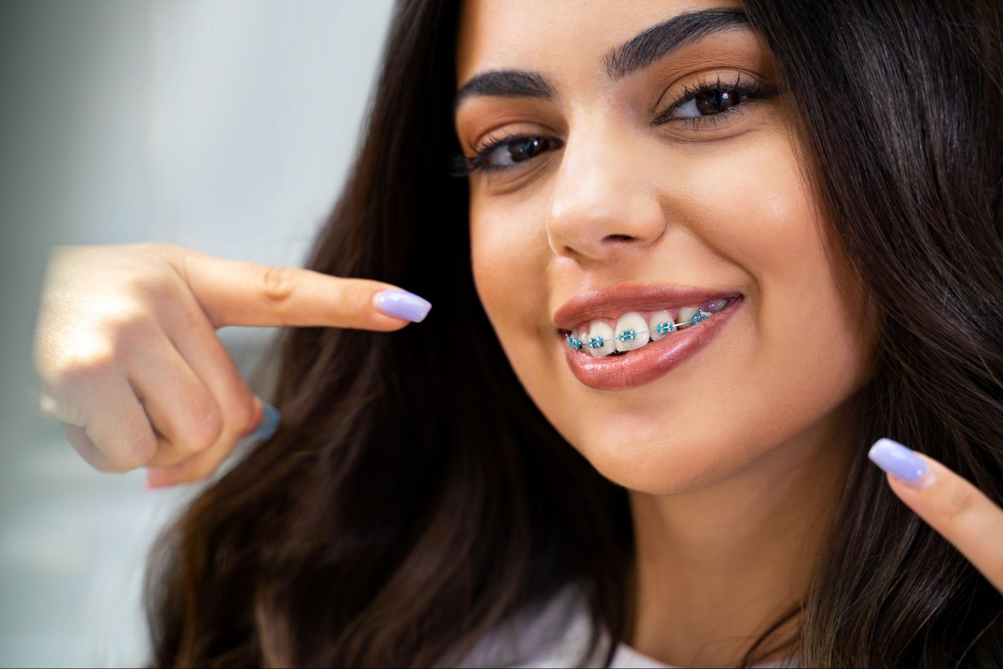10 Common Braces Issues and How To Handle Them